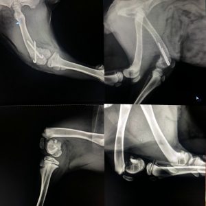 Femurun distal kısmında şekillenen kırık ve operasyon sonrası röntgenleri